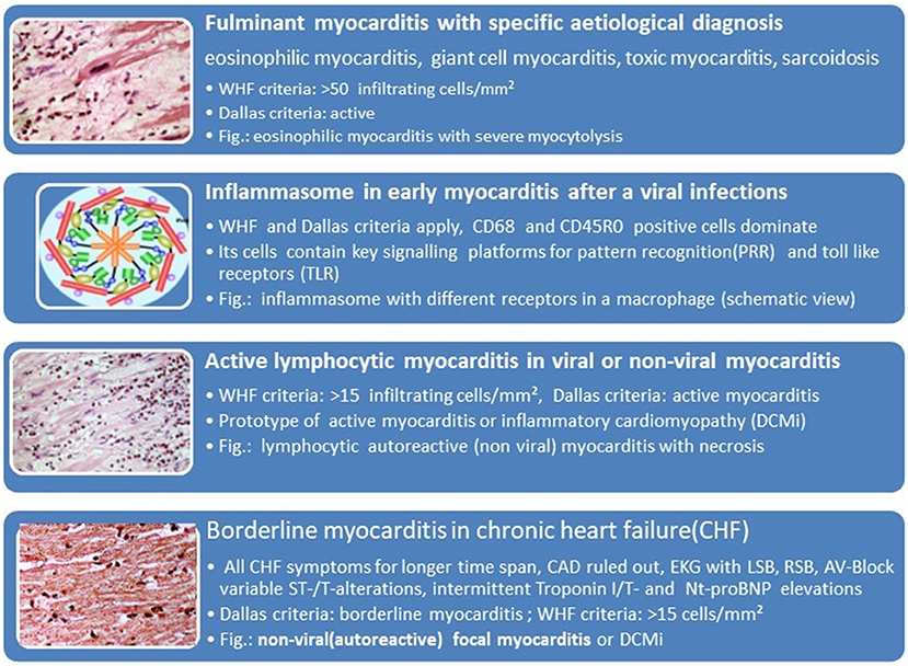 Inflammation of the Heart Muscle (Myocarditis): Causes, Symptoms, and Treatments