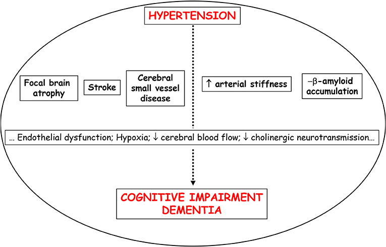 Vascular Dementia: Overview, Causes, Symptoms, and Care Options