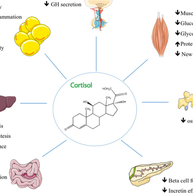 Cushing’s Syndrome: Understanding the Causes, Symptoms, and Treatments (Hypercortisolism)