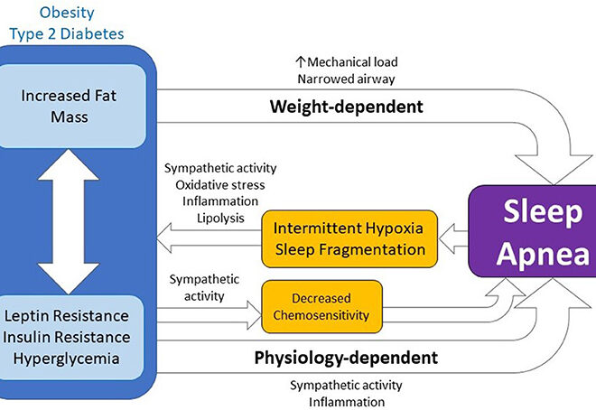 Sleep Apnea: Causes, Symptoms, Diagnosis, and Treatments