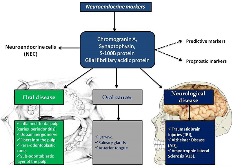 Neuroendocrine Tumors (NETs): Overview, Types, Symptoms & Care