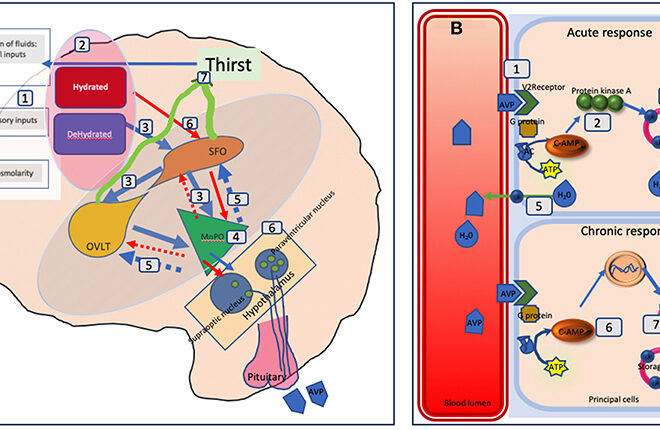 Diabetes Insipidus: Types, Causes, Symptoms, and Treatments