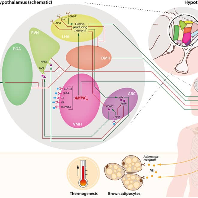 Narcolepsy: Understanding the Sleep Disorder and Its Effects