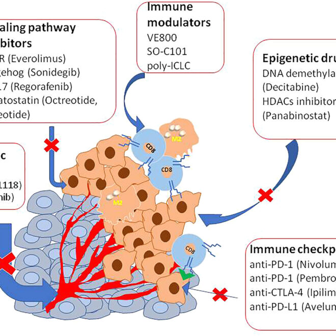 Neuroendocrine Tumors (NETs): Overview, Types, Symptoms & Care