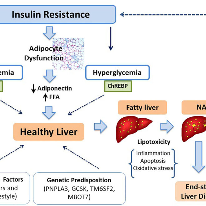 Nonalcoholic Fatty Liver Disease: Causes, Symptoms, Diagnosis & Care