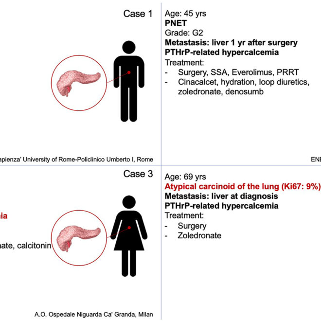 High Calcium Levels in the Blood (Hypercalcemia): Causes, Symptoms & Care