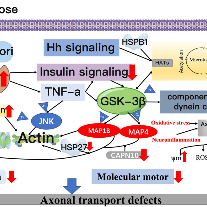 Peripheral Nerve Damage in Diabetes: Causes, Symptoms, and Care