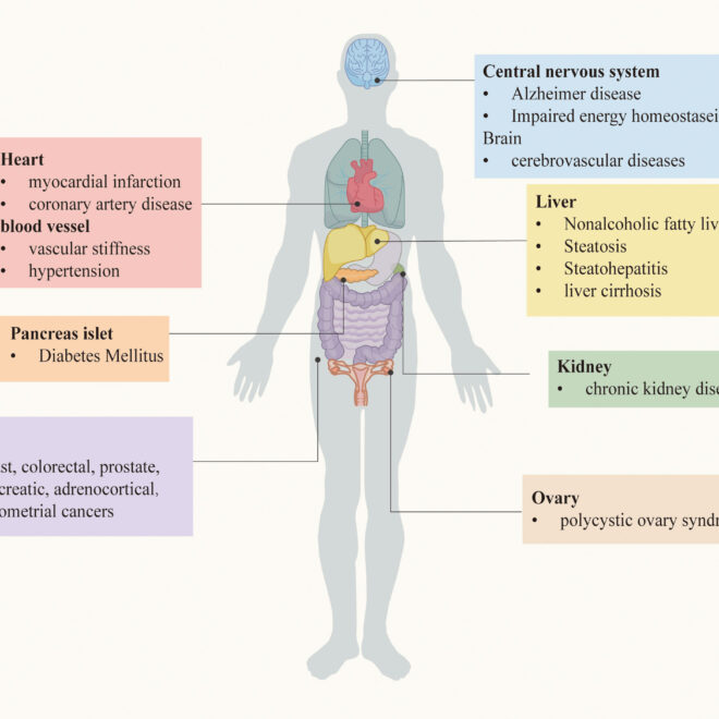 Insulin Resistance: Causes, Effects, and Management