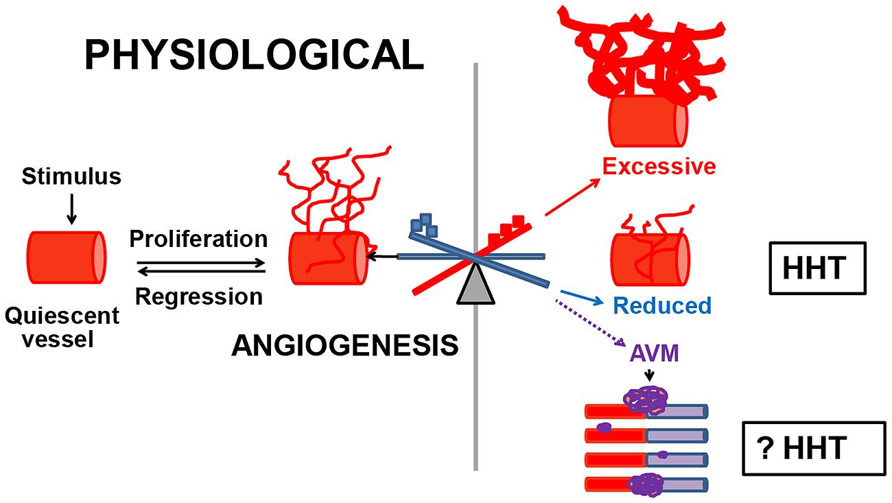 Hereditary Hemorrhagic Telangiectasia (HHT): Overview, Causes, Symptoms & Care