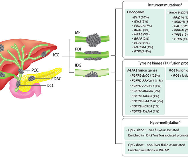 Bile Duct Cancer (Cholangiocarcinoma): Overview, Causes, Diagnosis, and Treatments