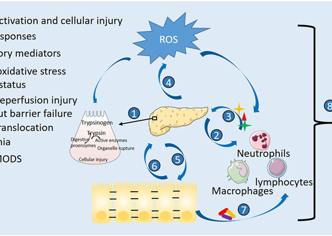 Pancreatitis: Understanding the Inflamed Pancreas, Its Causes, Symptoms, and Treatments