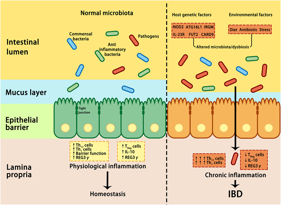Inflammatory Bowel Disease (IBD): Types, Causes, Symptoms, and Treatments