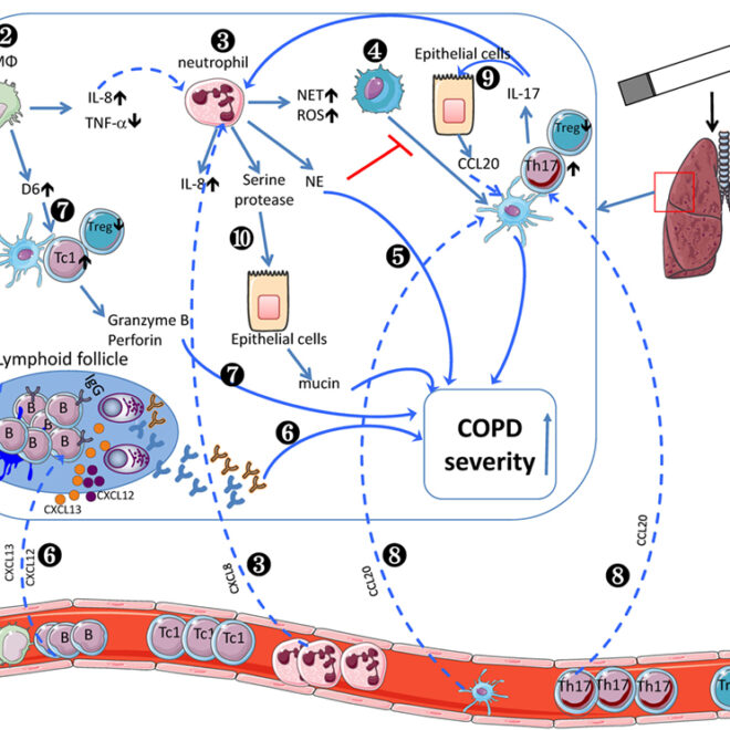 Chronic Lung Damage (Emphysema): Overview, Causes, Symptoms & Care