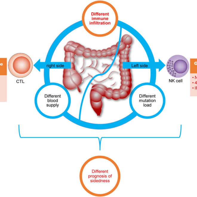 Colon Cancer: Understanding the Disease, Risk Factors, and Treatments