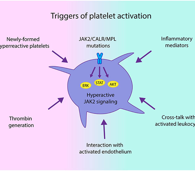 High Platelet Count (Thrombocythemia): Overview, Causes, Symptoms & Treatment