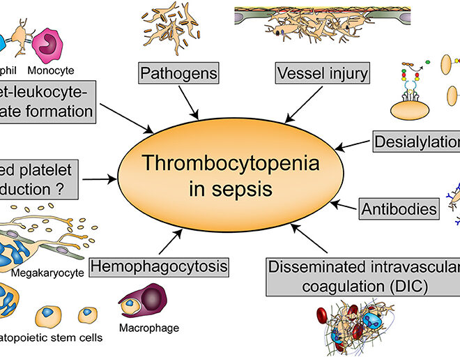 Low Platelet Count (Thrombocytopenia): Causes, Symptoms, and Treatments