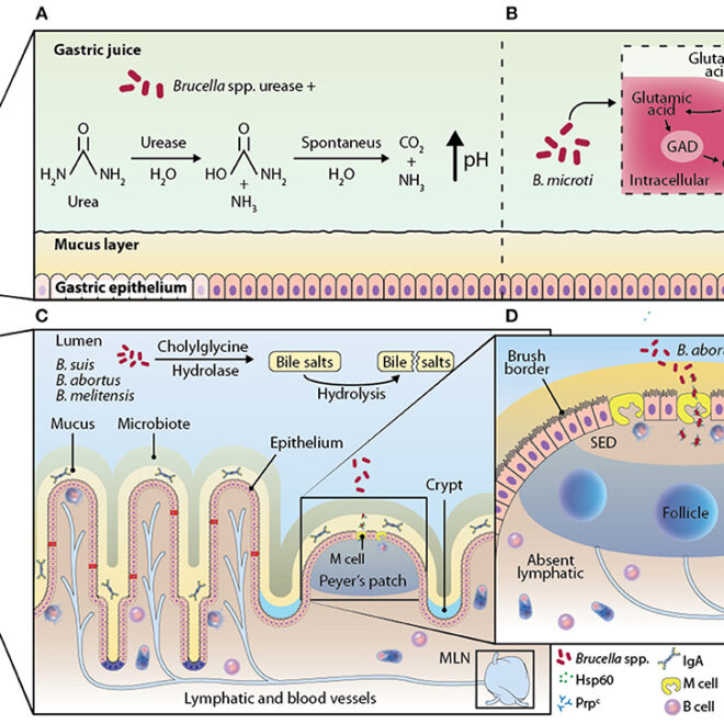 Brucellosis (Undulant Fever): Causes, Symptoms, Diagnosis & Treatment