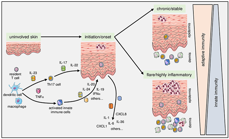Psoriasis: Understanding the Skin Condition, Its Triggers, and Treatments