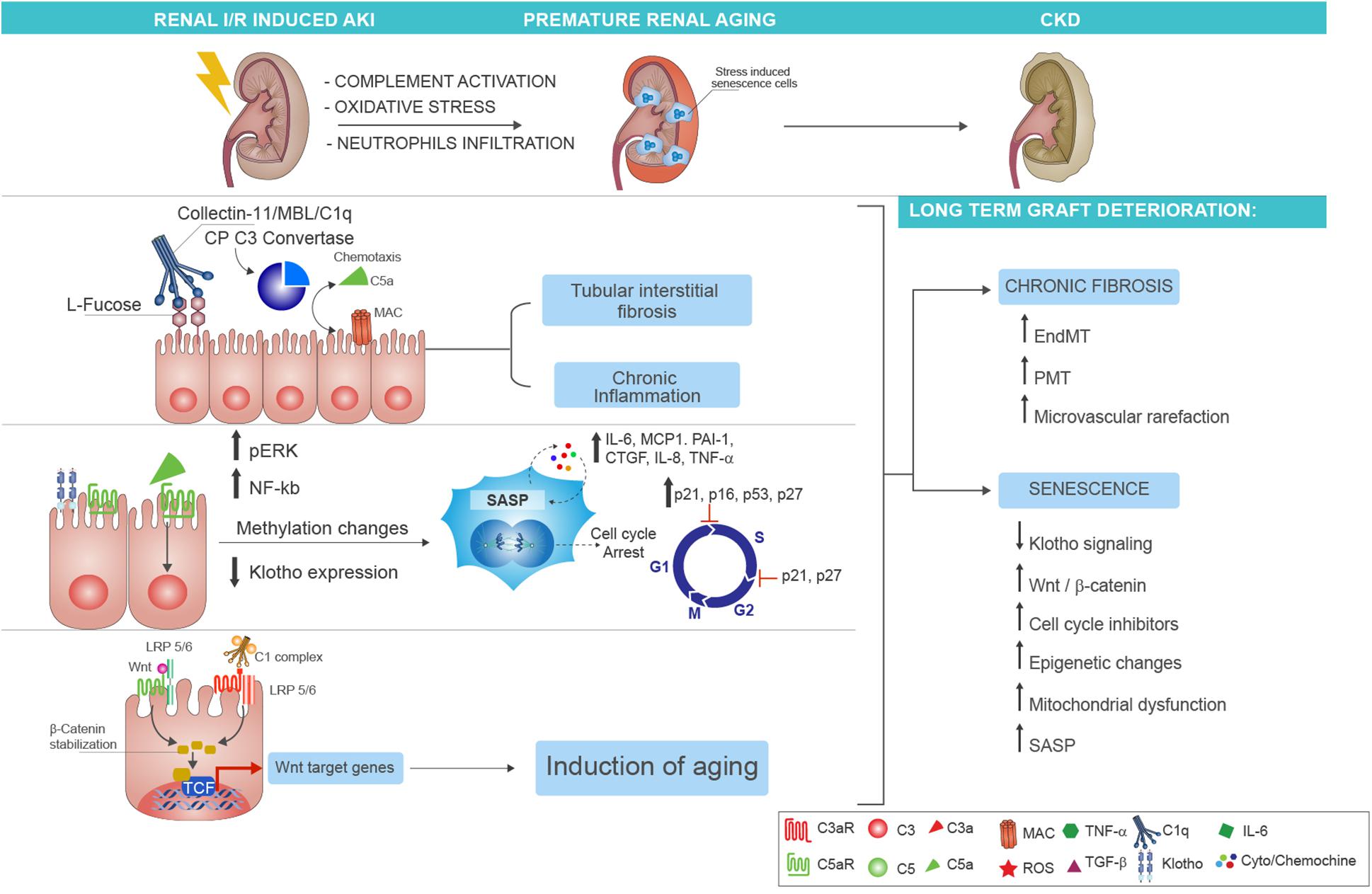 Kidney Inflammation (Nephritis): Causes, Symptoms, and Care