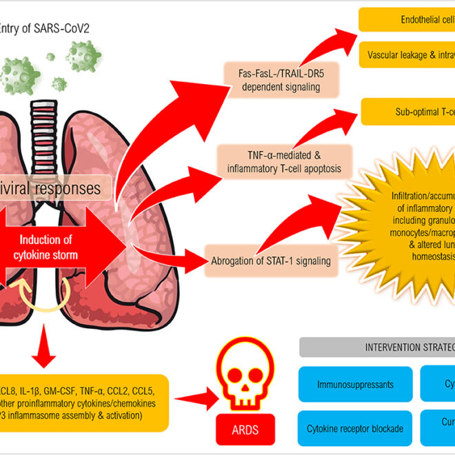 Severe Acute Respiratory Syndrome (SARS): Overview, Causes, Symptoms & Prevention