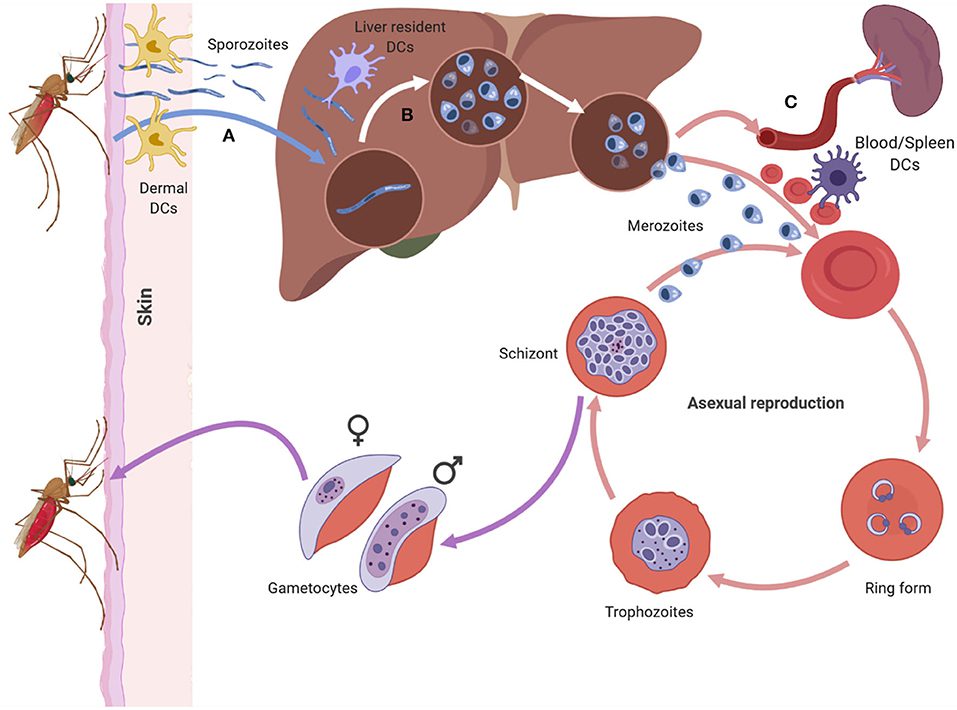 Malaria: Causes, Symptoms, Prevention, and Treatment