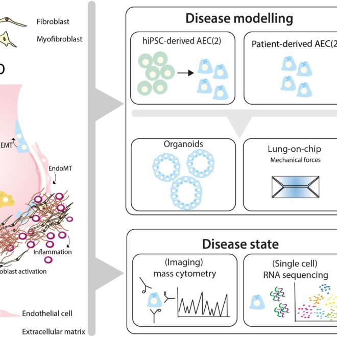 Nephrogenic Systemic Fibrosis: Causes, Symptoms, Diagnosis, and Treatment