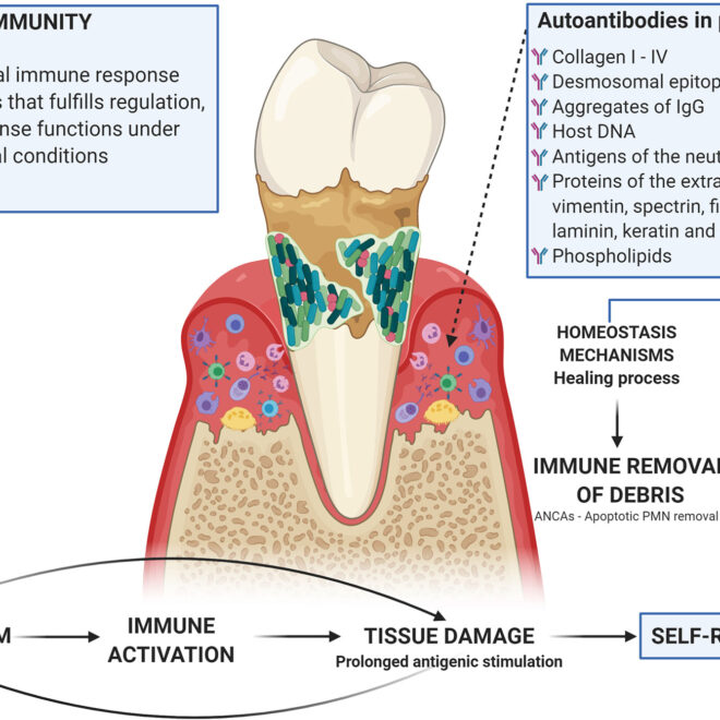 Gingivitis: Causes, Symptoms, Prevention, and Treatment