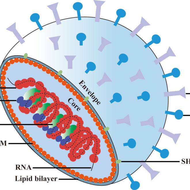 Mumps: Causes, Symptoms, Diagnosis, and Treatment (Parotitis)