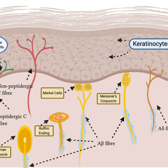 Nerve Pain (Neuralgia): Types, Causes, Symptoms, and Treatments