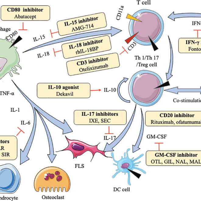 Rheumatoid Arthritis: What It Is, Causes, Symptoms & Treatment