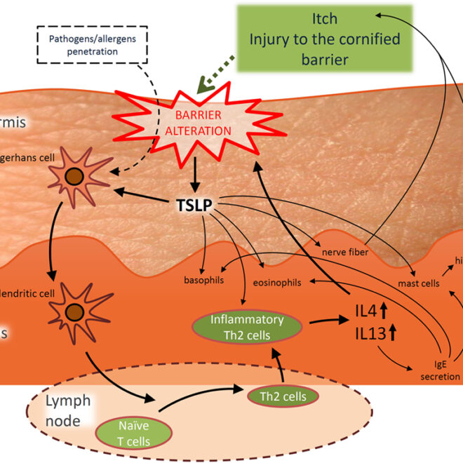 Stasis Dermatitis: Causes, Symptoms, and Care