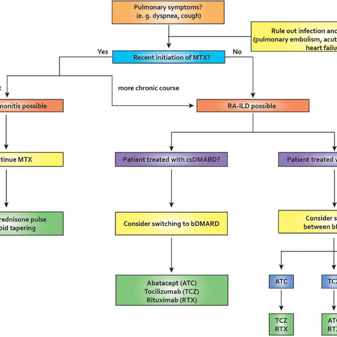 Pneumonitis: Causes, Symptoms, Diagnosis, and Treatment