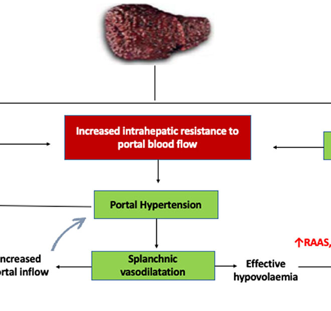 Cirrhosis Of The Liver: Causes, Symptoms, Diagnosis And Treatment