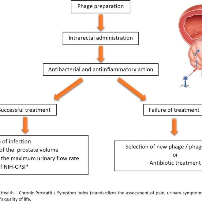 Prostatitis: Causes, Symptoms, Diagnosis, and Treatment Options