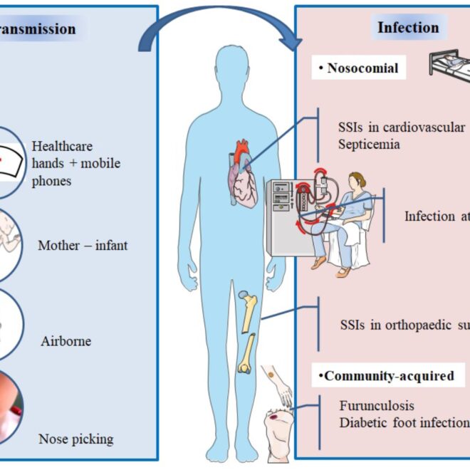 Staph Infections (Staphylococcus): Types, Causes, Symptoms & Treatments