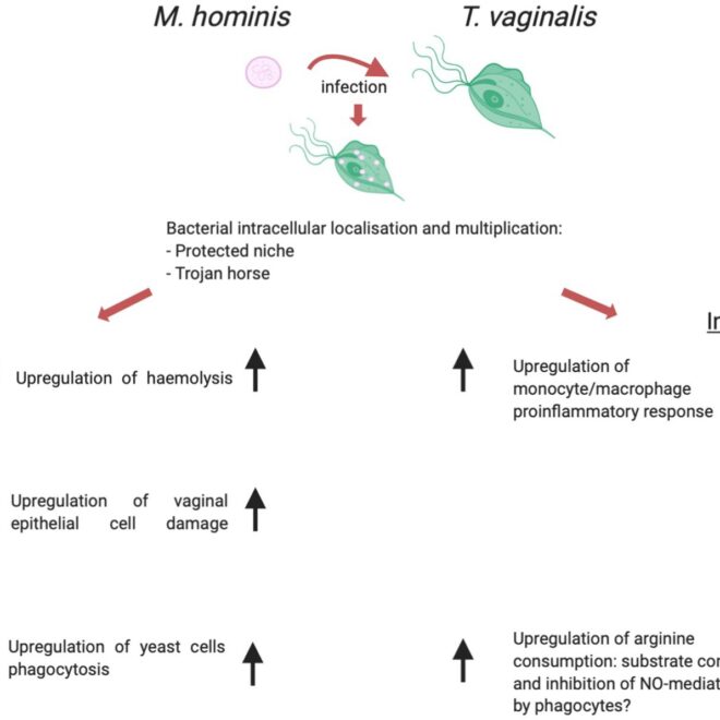 Trichomoniasis: Causes, Symptoms, Diagnosis, and Treatment (Sexually Transmitted Infection)