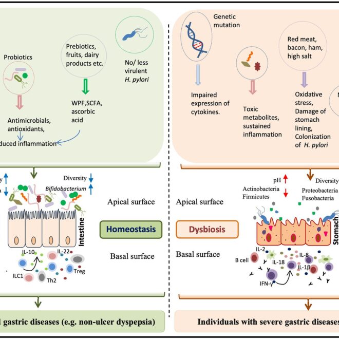 Gastritis: Causes, Symptoms, Treatment, and Prevention