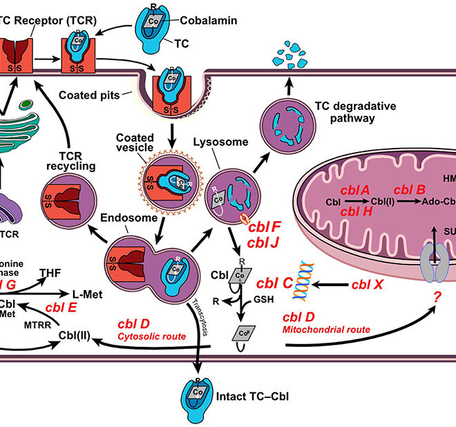 Pernicious Anemia (Vitamin B12 Deficiency): Causes, Symptoms & Care