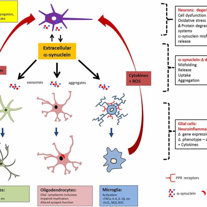 Multiple System Atrophy: Overview, Symptoms, Diagnosis & Care