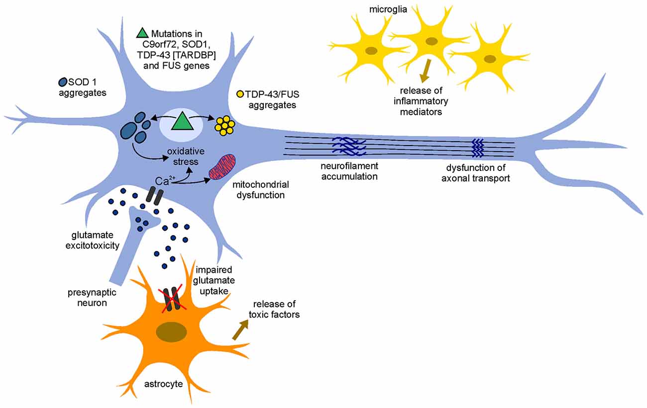 Amyotrophic Lateral Sclerosis (ALS): A Complete Overview