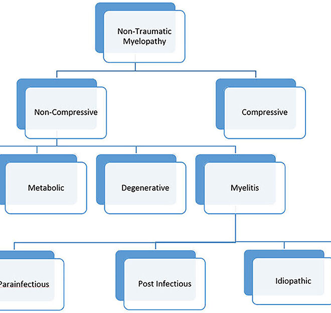 Transverse Myelitis: Causes, Symptoms, Diagnosis, and Treatment