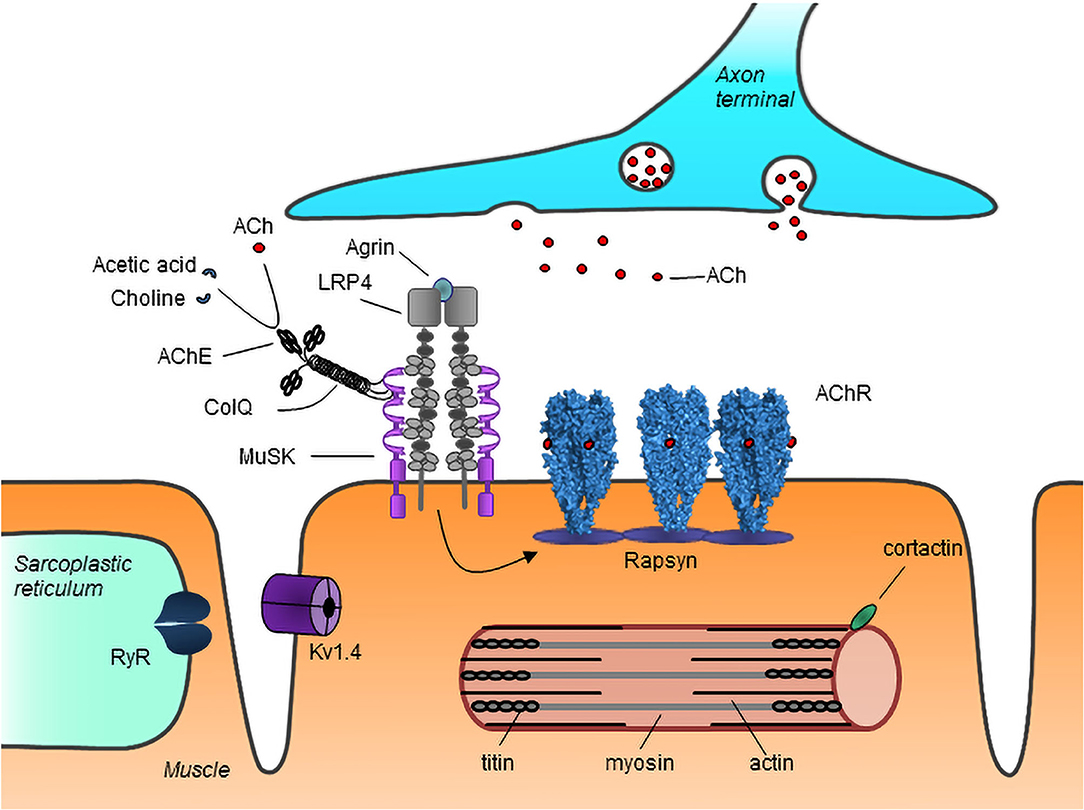 Myasthenia Gravis: Understanding Muscle Weakness and Its Causes