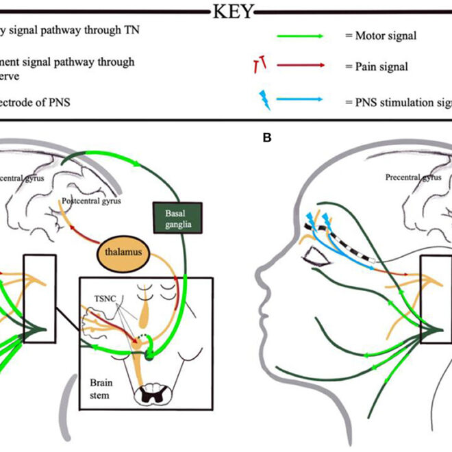 Peripheral Neuropathy: Causes, Symptoms, Types, and Treatments