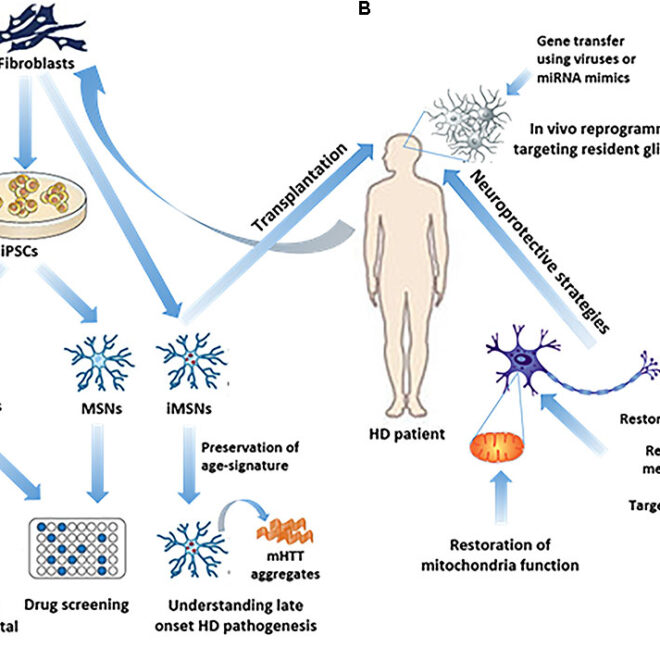 Huntington’s Disease (HD): A Complete Guide to Understanding the Disorder