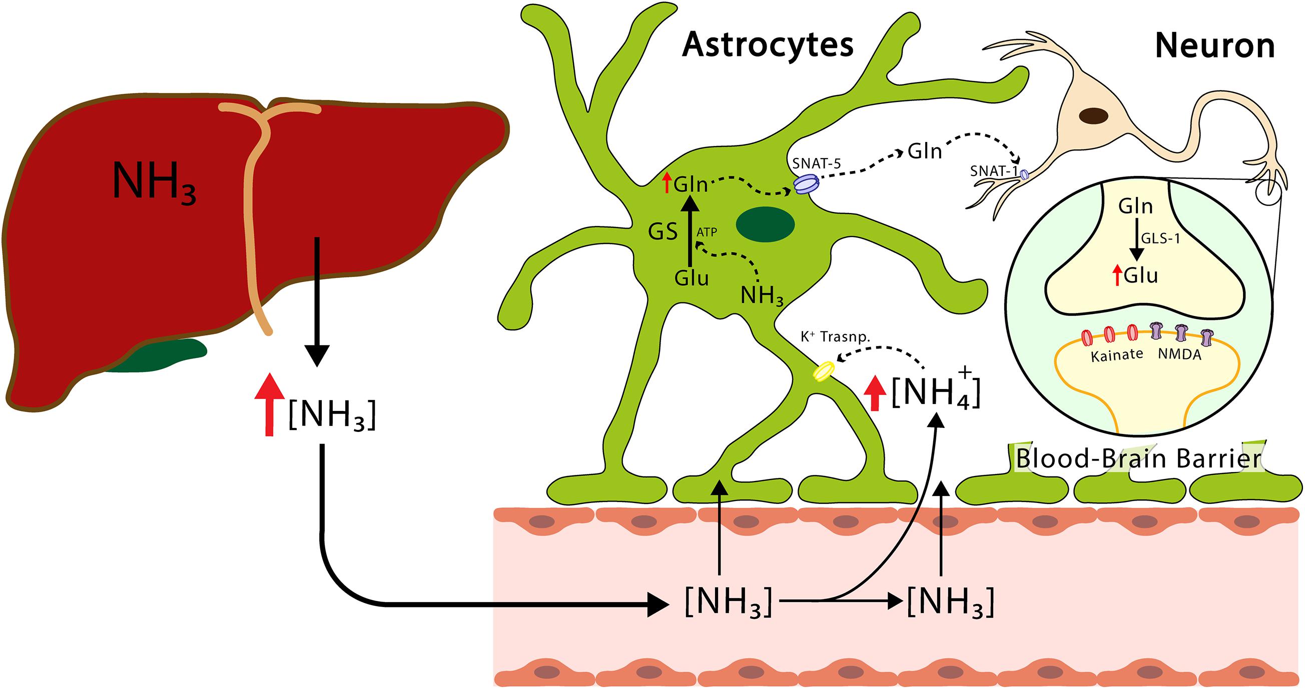 Liver Brain Disorder (Hepatic Encephalopathy): Causes, Symptoms & Care