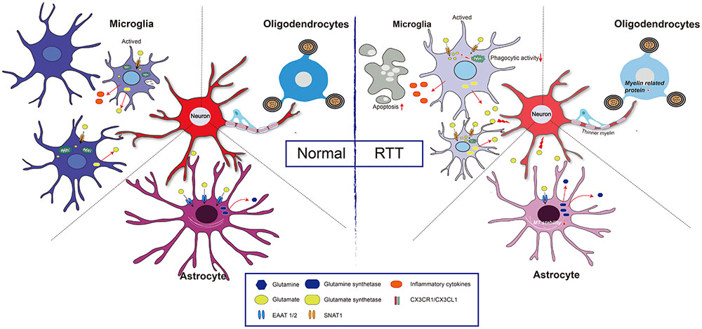 Rett Syndrome: A Detailed Overview of Symptoms, Causes, and Care