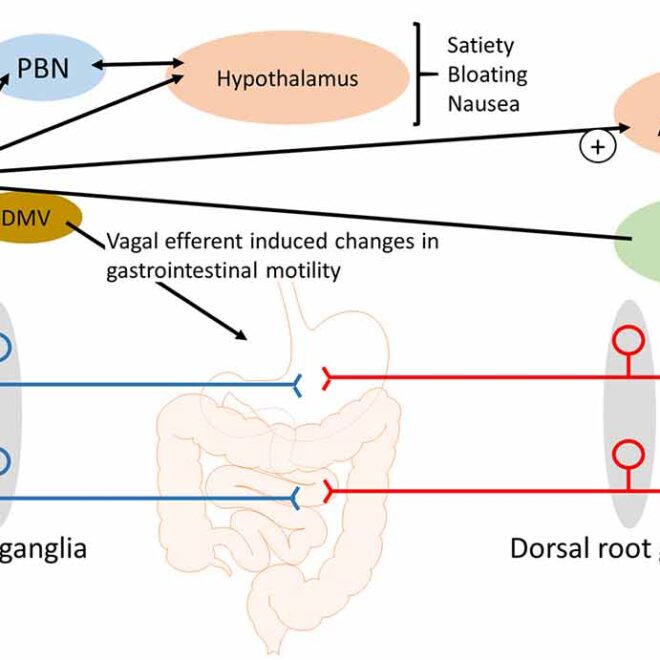Dyspepsia (Indigestion): Causes, Symptoms, and Treatments