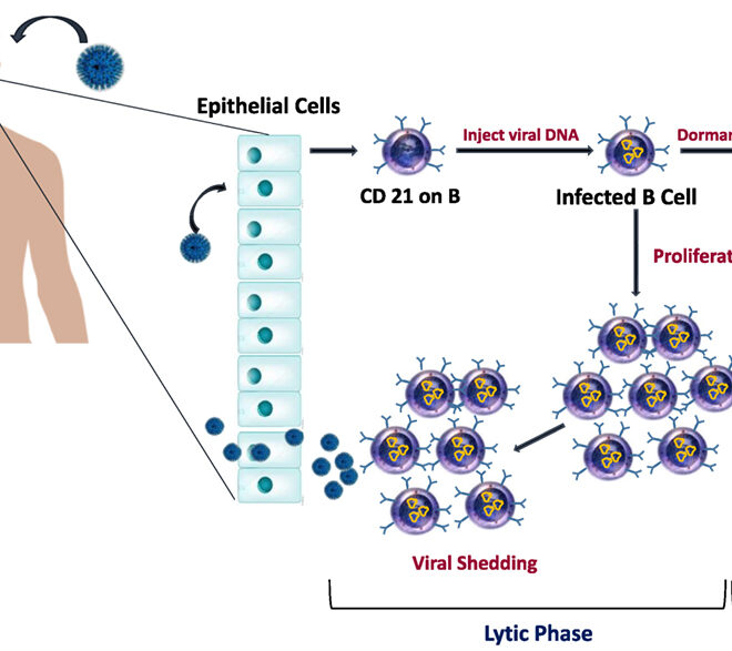 Epstein-Barr Virus Infection (EBV): Overview, Symptoms, and Treatments