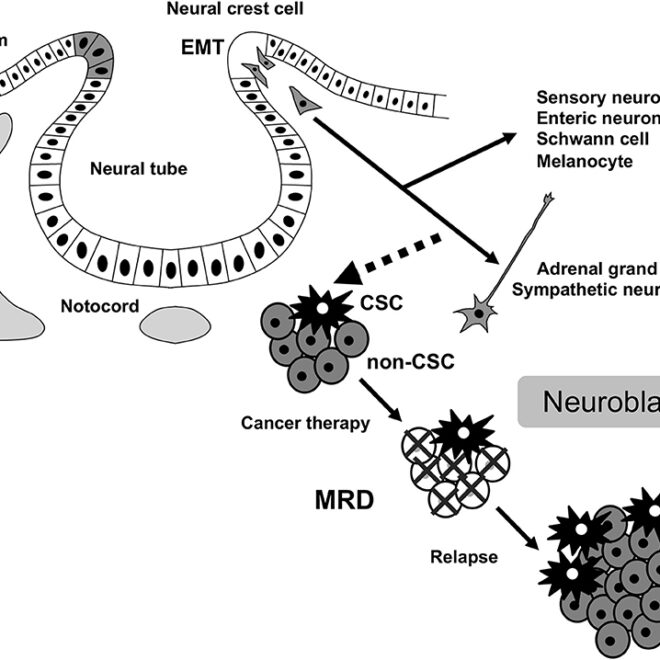 Neuroblastoma: A Guide to the Childhood Cancer of Nerve Cells