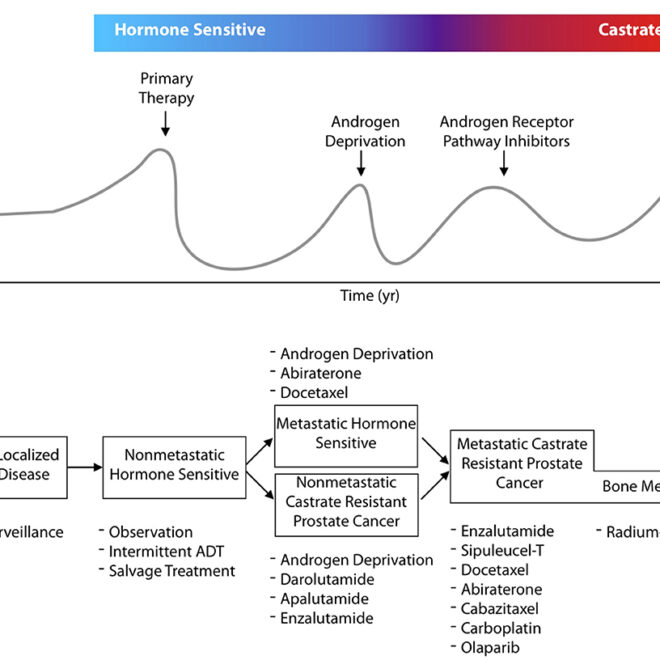 Prostate Cancer: Understanding the Disease, Diagnosis, and Treatments